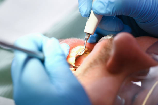 Best Emergency Dental Services for Seniors in Mercedes, TX