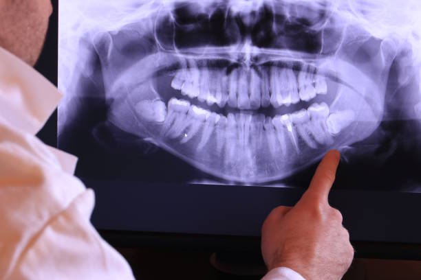 Best Urgent Dental Care for Toothache in Mercedes, TX