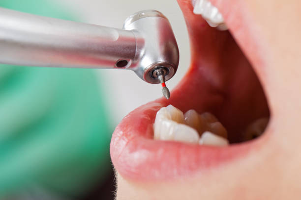 Best Pediatric Emergency Dentist in Mercedes, TX
